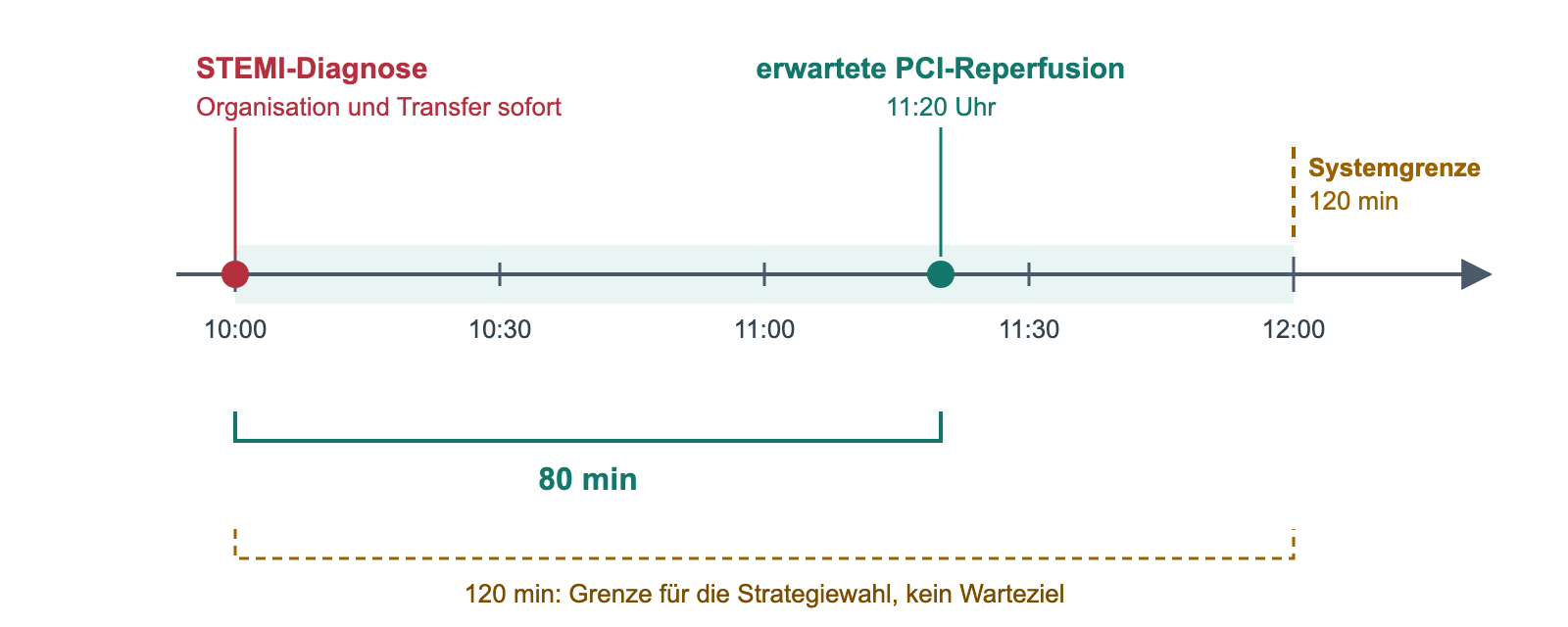 Zeitstrahl von 10:00 bis 12:00 Uhr: STEMI-Diagnose um 10:00 Uhr, erwartete PCI-Reperfusion um 11:20 Uhr nach 80 Minuten, Systemgrenze 120 Minuten um 12:00 Uhr