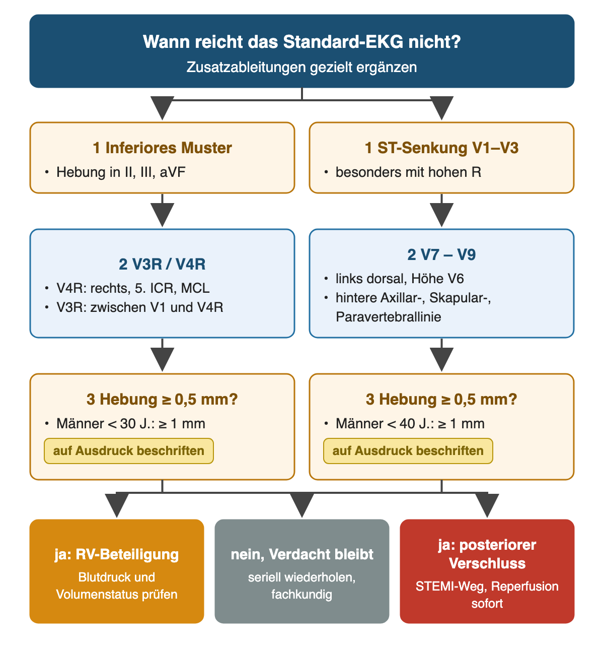 Zwei parallele Wege: inferiores Muster in II, III, aVF führt zu V3R/V4R rechts im fünften Interkostalraum, ST-Senkung V1–V3 mit hohen R führt zu V7–V9 links dorsal auf Höhe von V6; jeweils Hebung ab 0,5 mm, bei Männern unter 30 beziehungsweise unter 40 Jahren ab 1 mm; Ergebnisse RV-Beteiligung mit Prüfung von Blutdruck und Volumenstatus, posteriorer Verschluss mit STEMI-Weg oder bei fehlender Hebung serielle Wiederholung und fachkundige Beurteilung.