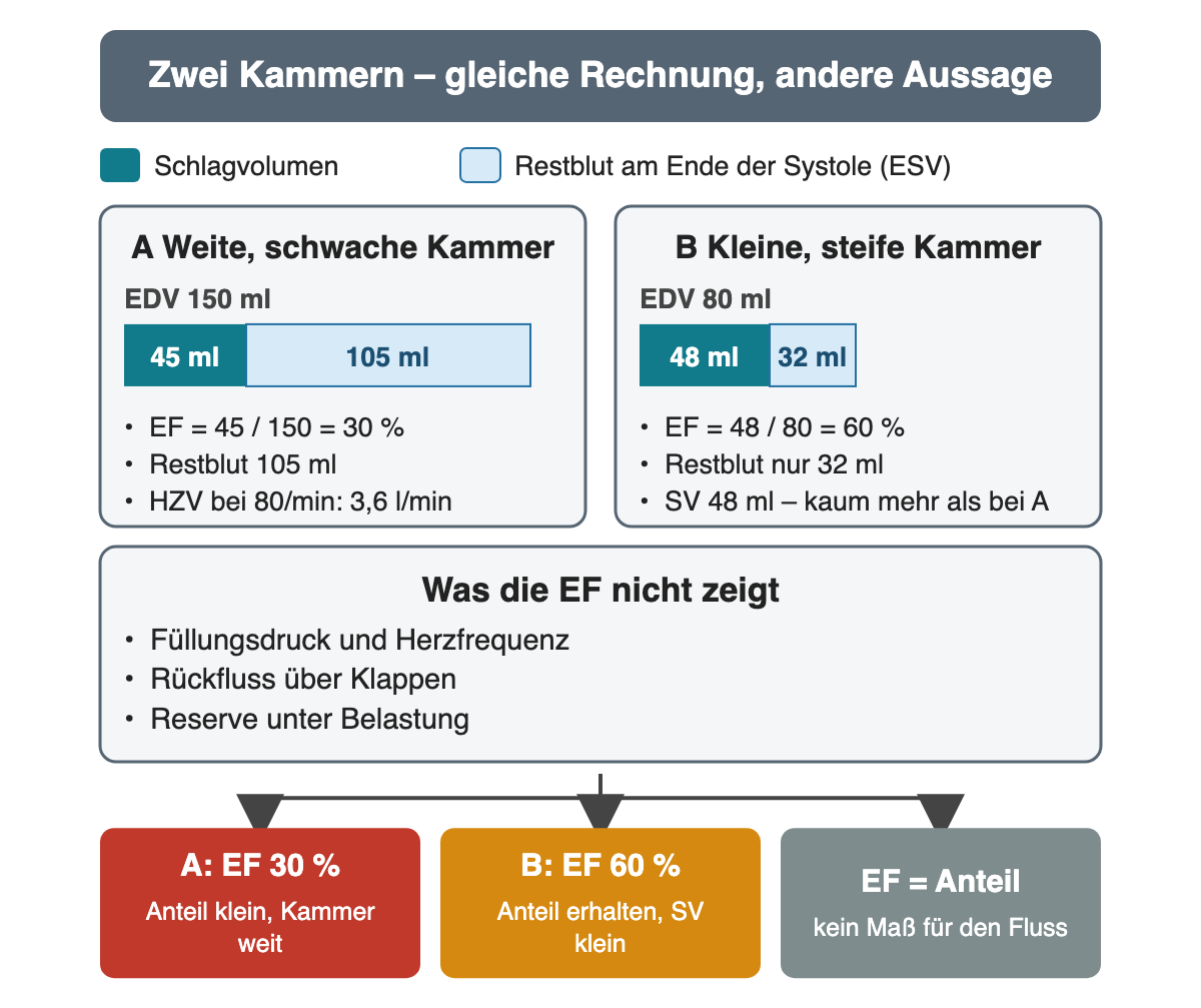 Zwei Kammern im gleichen Maßstab als Balken: A mit EDV 150 ml, davon 45 ml Schlagvolumen und 105 ml Restblut, EF 30 Prozent; B mit EDV 80 ml, davon 48 ml Schlagvolumen und 32 ml Restblut, EF 60 Prozent. Darunter, was die EF nicht zeigt: Füllungsdruck, Herzfrequenz, Klappenrückfluss und Belastungsreserve. Ergebnisfelder: A Anteil klein, B Anteil erhalten bei kleinem Schlagvolumen, EF ist ein Anteil.