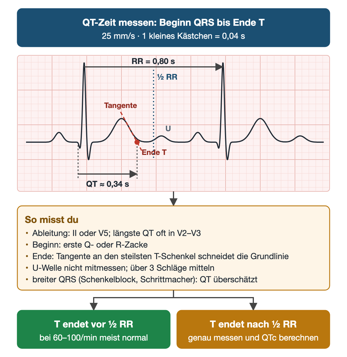 Schematischer EKG-Ausschnitt auf Millimeterpapier mit zwei Herzschlägen: RR 0,80 Sekunden, gestrichelte Linie bei der halben RR-Strecke, rote Tangente am absteigenden T-Schenkel mit Punkt am T-Ende auf der Grundlinie, kleine U-Welle danach, QT-Pfeil vom QRS-Beginn bis zum T-Ende mit 0,34 Sekunden; darunter die Messregeln und zwei Ergebnisse zum Schnellcheck