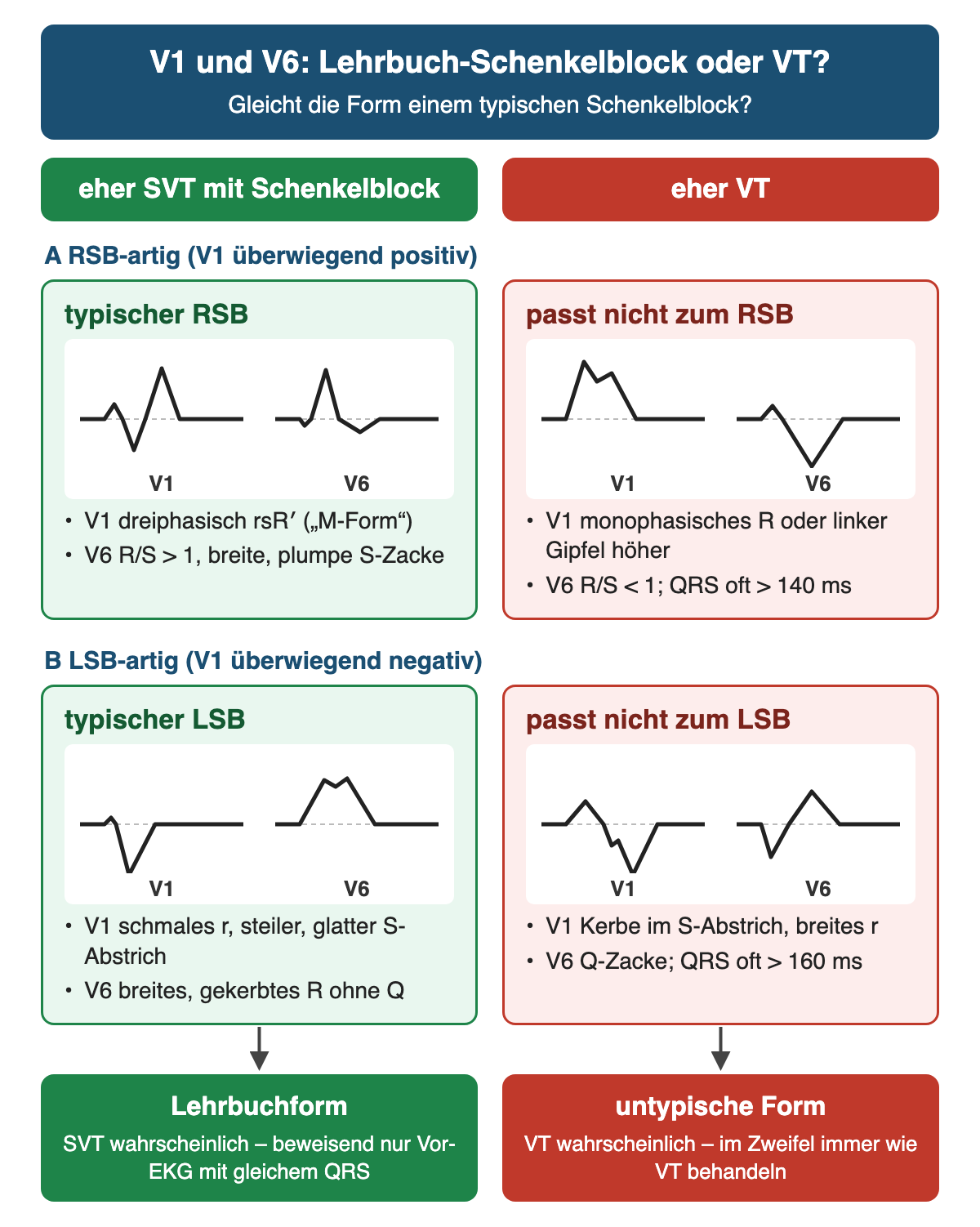 Vier Felder mit schematischen QRS-Formen in V1 und V6: typischer Rechtsschenkelblock mit rsR′ und R/S größer 1 neben VT-Form mit monophasischem R und R/S kleiner 1, typischer Linksschenkelblock mit glattem S-Abstrich und R ohne Q neben VT-Form mit gekerbtem S-Abstrich und Q in V6.