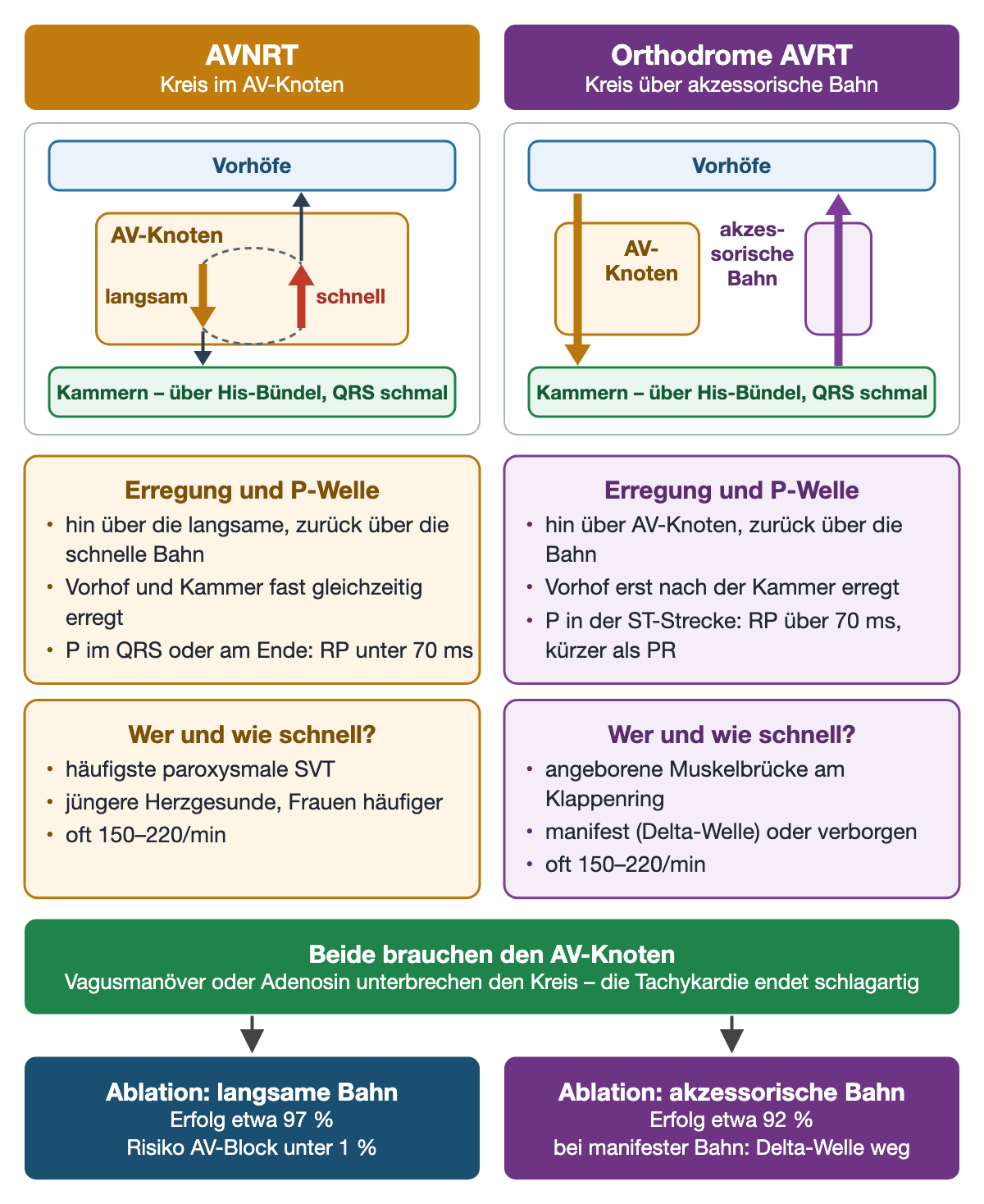 Zwei Spalten: links der AVNRT-Kreis im AV-Knoten über langsame und schnelle Bahn mit RP unter 70 ms, rechts der Kreis der orthodromen AVRT über AV-Knoten, Kammer und akzessorische Bahn mit RP über 70 ms; darunter Häufigkeit, Frequenz 150–220/min und das jeweilige Ablationsziel