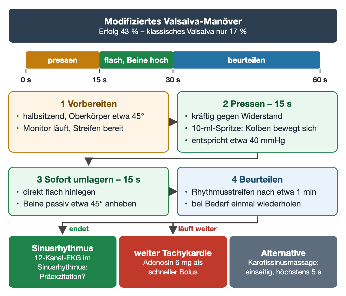 Zeitleiste des modifizierten Valsalva-Manövers: 0–15 s pressen, 15–30 s flach mit angehobenen Beinen, danach beurteilen; vier Schritte mit 45° Oberkörper, 10-ml-Spritze etwa 40 mmHg, Beine 45° und Streifen nach etwa 1 min; Ausgänge Sinusrhythmus, weiter Tachykardie mit Adenosin 6 mg, Alternative Karotissinusmassage