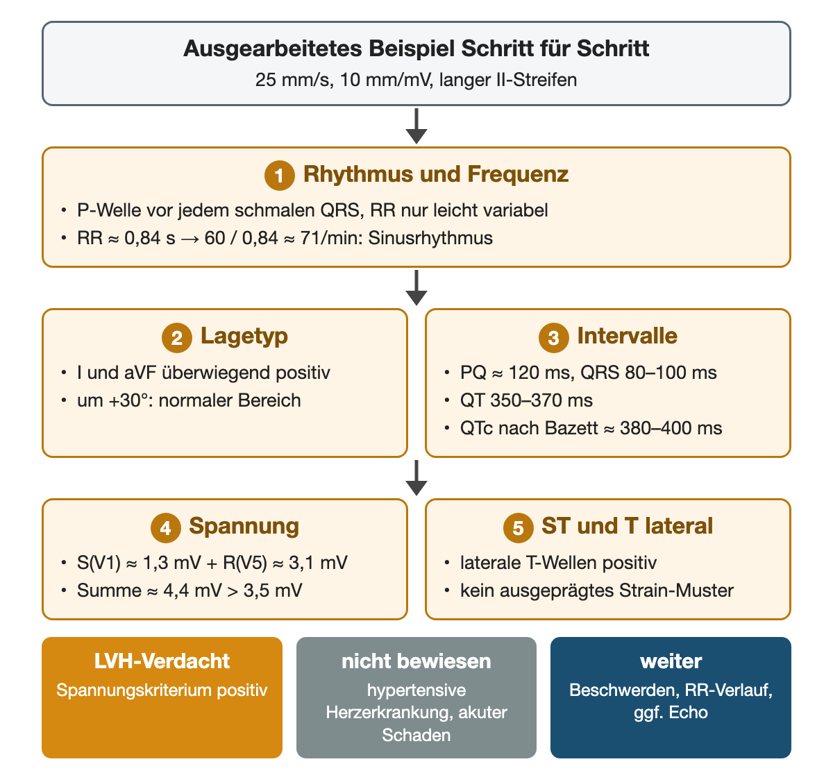 Ausgearbeitetes Beispiel in fünf Schritten: 1 P-Welle vor jedem schmalen QRS, RR etwa 0,84 s, 60 geteilt durch 0,84 ergibt etwa 71/min, Sinusrhythmus. 2 Lagetyp, I und aVF überwiegend positiv, um +30°, normaler Bereich. 3 Intervalle, PQ etwa 120 ms, QRS 80 bis 100 ms, QT 350 bis 370 ms, QTc nach Bazett etwa 380 bis 400 ms. 4 Spannung, S in V1 etwa 1,3 mV plus R in V5 etwa 3,1 mV, Summe etwa 4,4 mV über 3,5 mV. 5 laterale T-Wellen positiv, kein ausgeprägtes Strain-Muster. Ergebnis: Hypertrophieverdacht bei positivem Spannungskriterium; eine hypertensive Herzerkrankung oder ein akuter Schaden ist nicht bewiesen; weiter nach Beschwerden, Blutdruckverlauf und gegebenenfalls Echokardiographie.
