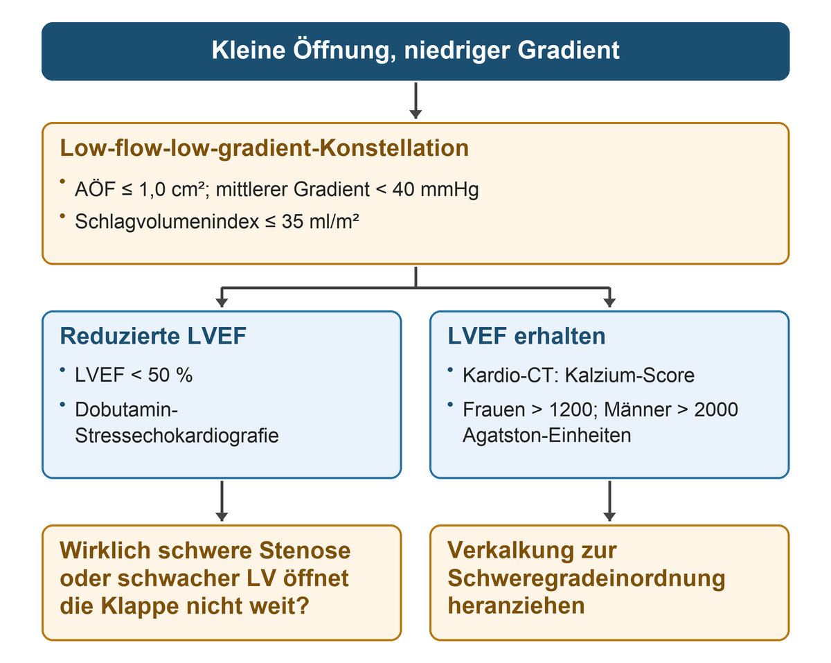 Oben stehen kleine Öffnungsfläche, niedriger mittlerer Gradient und niedriger Schlagvolumenindex; nach LVEF verzweigt der Weg zur Dobutamin-Stressechokardiografie oder zum CT-Kalzium-Score.