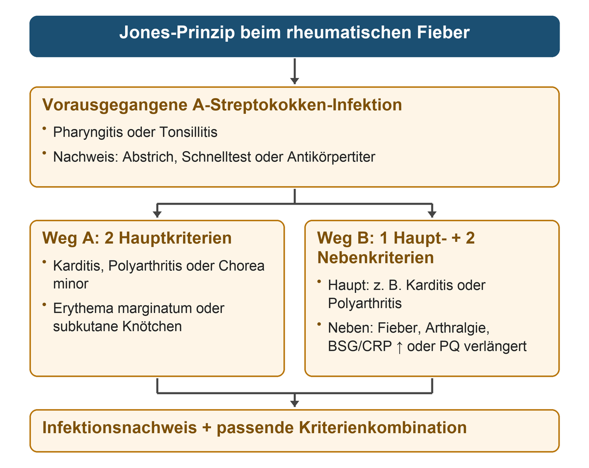 Oben Nachweis einer vorausgegangenen A-Streptokokken-Infektion; darunter die Alternativen zwei Hauptkriterien oder ein Haupt- und zwei Nebenkriterien, die unten mit dem Infektionsnachweis verbunden werden.