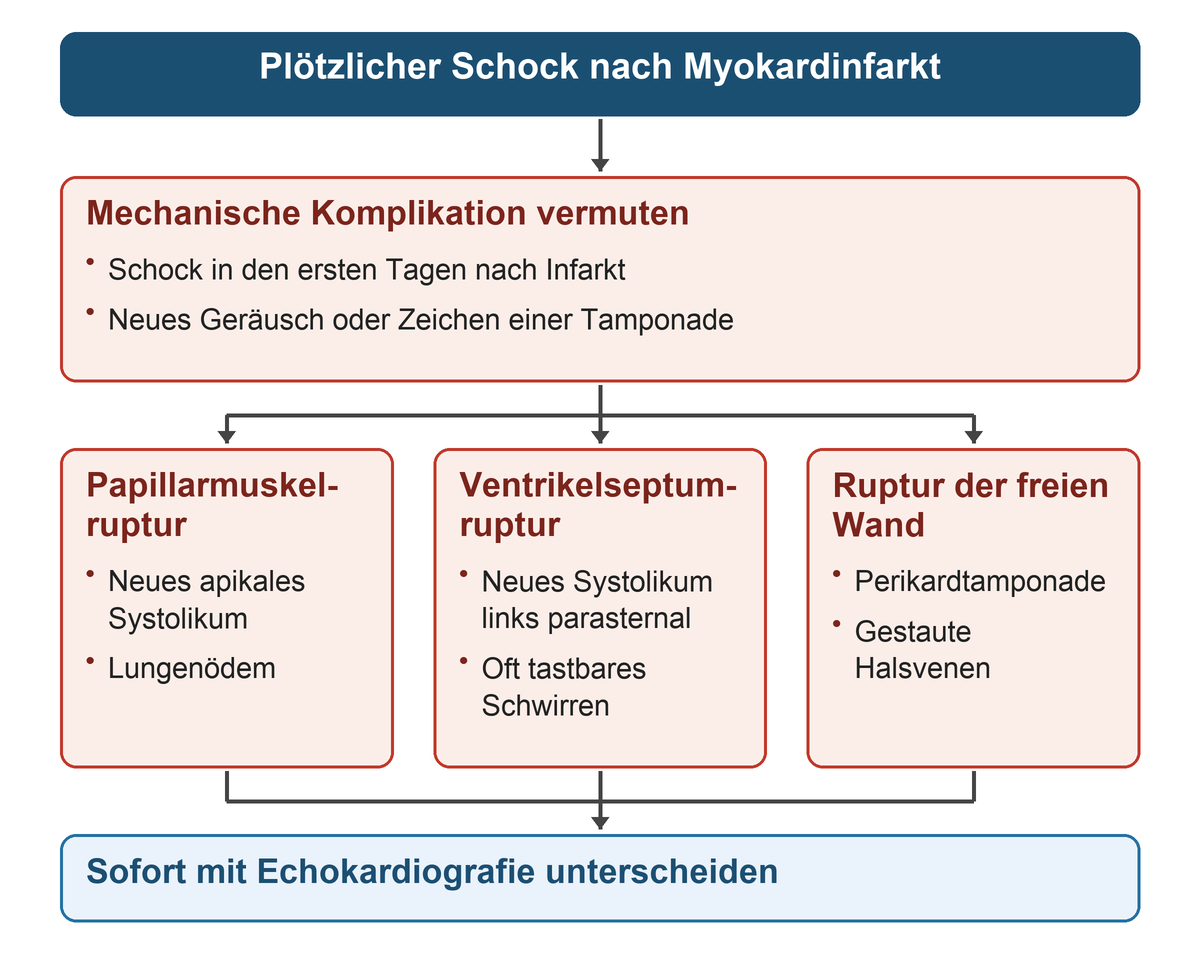 Ein plötzlicher Schock nach Infarkt verzweigt zu Papillarmuskelruptur mit apikalem Systolikum und Lungenödem, Septumruptur mit parasternalem Geräusch und Schwirren sowie freier Wandruptur mit Tamponadezeichen; alle Wege führen zur sofortigen Echokardiografie.