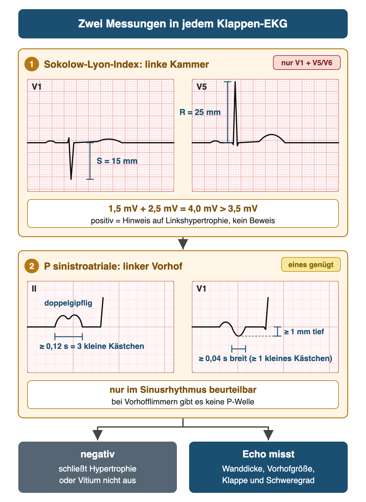 Oben zwei schematische Ableitungen auf Millimeterpapier: V1 mit tiefer S-Zacke von 15 mm und V5 mit hoher R-Zacke von 25 mm, darunter die Rechnung 1,5 mV plus 2,5 mV gleich 4,0 mV, größer als 3,5 mV. Unten zwei vergrößerte P-Wellen: in II breit und doppelgipflig über 3 kleine Kästchen, in V1 biphasisch mit negativem Endteil von mindestens 1 mm Tiefe und mindestens einem kleinen Kästchen Breite; ganz unten: negativ schließt nichts aus, Echo misst.