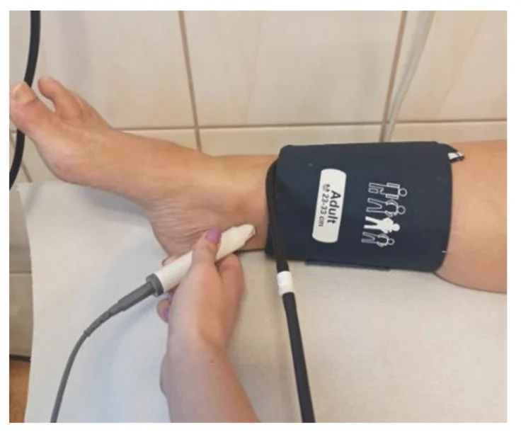 Liegendes Bein mit Blutdruckmanschette knapp oberhalb des Knöchels; eine Hand hält eine stiftförmige Doppler-Sonde hinter den Innenknöchel