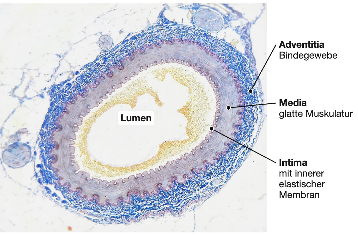 Lichtmikroskopischer Querschnitt einer muskulären Arterie: innen das Lumen mit Blutzellen, darum die gewellte innere elastische Membran der Intima, die breite Media aus glatter Muskulatur und außen die faserreiche Adventitia