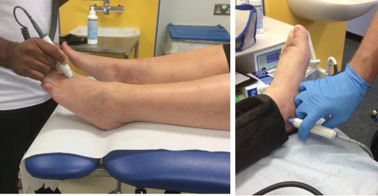 Zwei Fotos: links hält ein Untersucher eine stiftförmige Dopplersonde auf den Fußrücken, die Hand am Fuß abgestützt; rechts liegt eine Blutdruckmanschette über dem Knöchel, und die Sonde sitzt hinter dem Innenknöchel