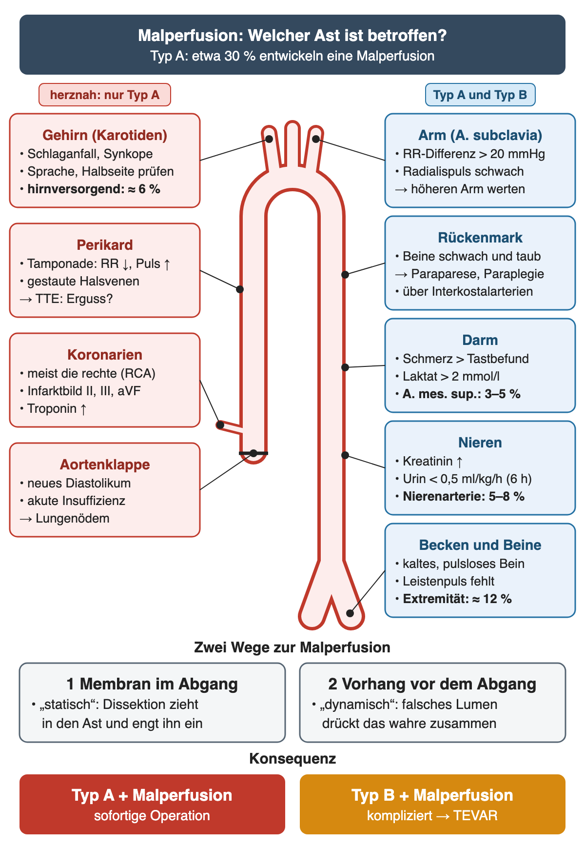Schematische Aorta von der Klappe bis zur Bifurkation; links rote Kästen für die herznahen Folgen bei Typ A (Gehirn, Perikard, Koronarien, Aortenklappe), rechts blaue Kästen für Arm, Rückenmark, Darm, Nieren und Beine mit Zeichen, Grenzwerten und Häufigkeiten; unten die zwei Mechanismen und die Konsequenz für Typ A und B