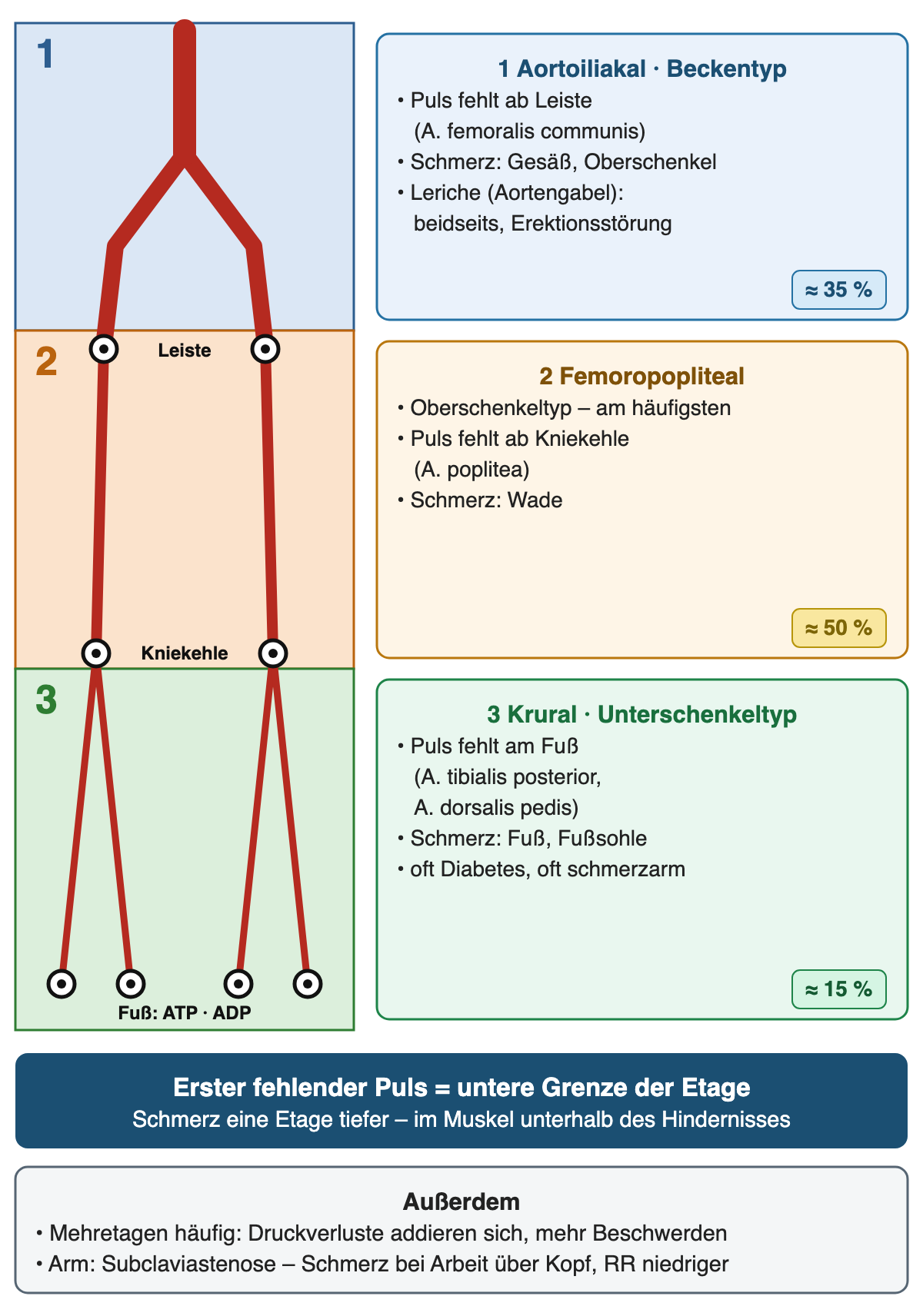 Vereinfachter Arterienbaum von der Bauchaorta bis zum Fuß in drei farbigen Etagen mit Pulsorten an Leiste, Kniekehle und Fuß; rechts je Etage ein Kasten mit erstem fehlendem Puls, Schmerzort und Häufigkeit (Beckentyp etwa 35 %, Oberschenkeltyp etwa 50 %, Unterschenkeltyp etwa 15 %); darunter die Regel zum ersten fehlenden Puls sowie Hinweise zu Mehretagenerkrankung und Armbefall