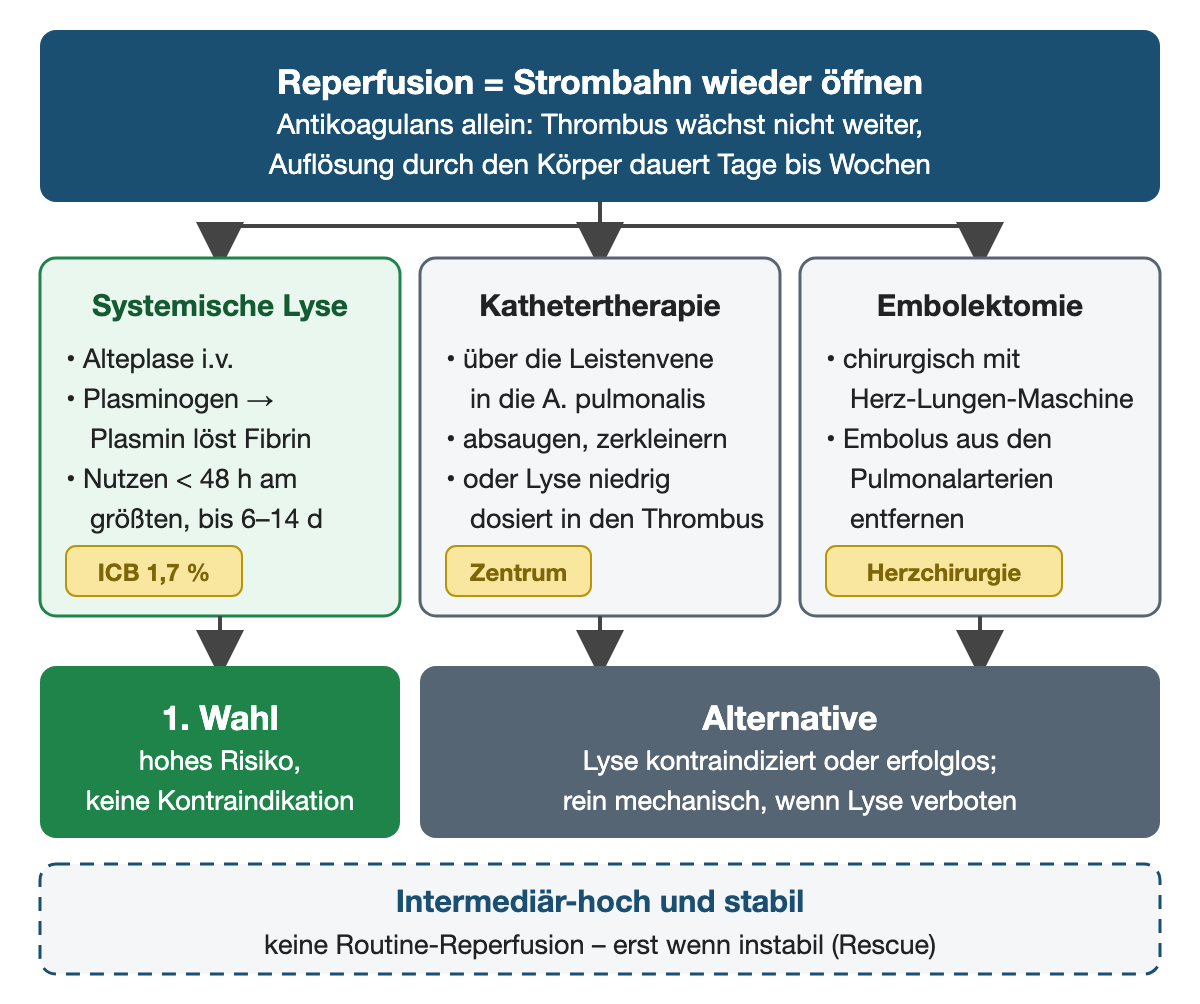 Vergleichsdiagramm: oben Reperfusion heißt Strombahn wieder öffnen, ein Antikoagulans allein verhindert nur das Wachstum. Darunter drei Kästen nebeneinander: systemische Lyse mit Alteplase i.v., Plasmin löst Fibrin, Nutzen in den ersten 48 h am größten, wirkt bis 6–14 Tage, Hinweis intrakranielle Blutung 1,7 %; Kathetertherapie über die Leistenvene in die Pulmonalarterie mit Absaugen, Zerkleinern oder niedrig dosierter Lyse, Hinweis Zentrum; Embolektomie mit Herz-Lungen-Maschine, Hinweis Herzchirurgie. Unten: Lyse ist erste Wahl bei hohem Risiko ohne Kontraindikation, Katheter und OP sind die Alternative; gestrichelt: intermediär-hoch und stabil keine Routine-Reperfusion