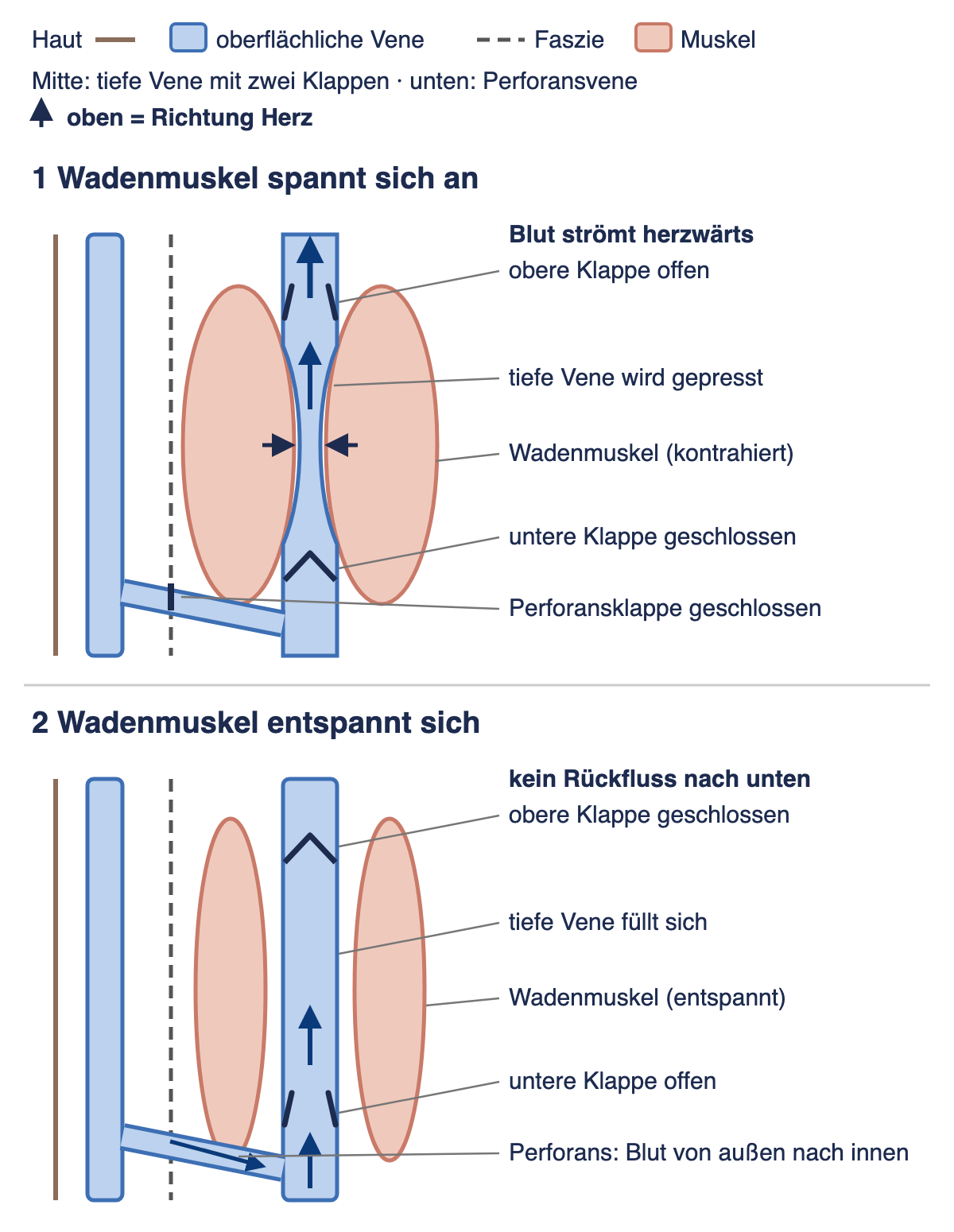 Zwei übereinander angeordnete Schemata eines Unterschenkelausschnitts mit Haut, oberflächlicher Vene, Faszie, Wadenmuskulatur, tiefer Vene mit zwei Klappen und einer Perforansvene; oben bei Muskelanspannung, unten bei Entspannung