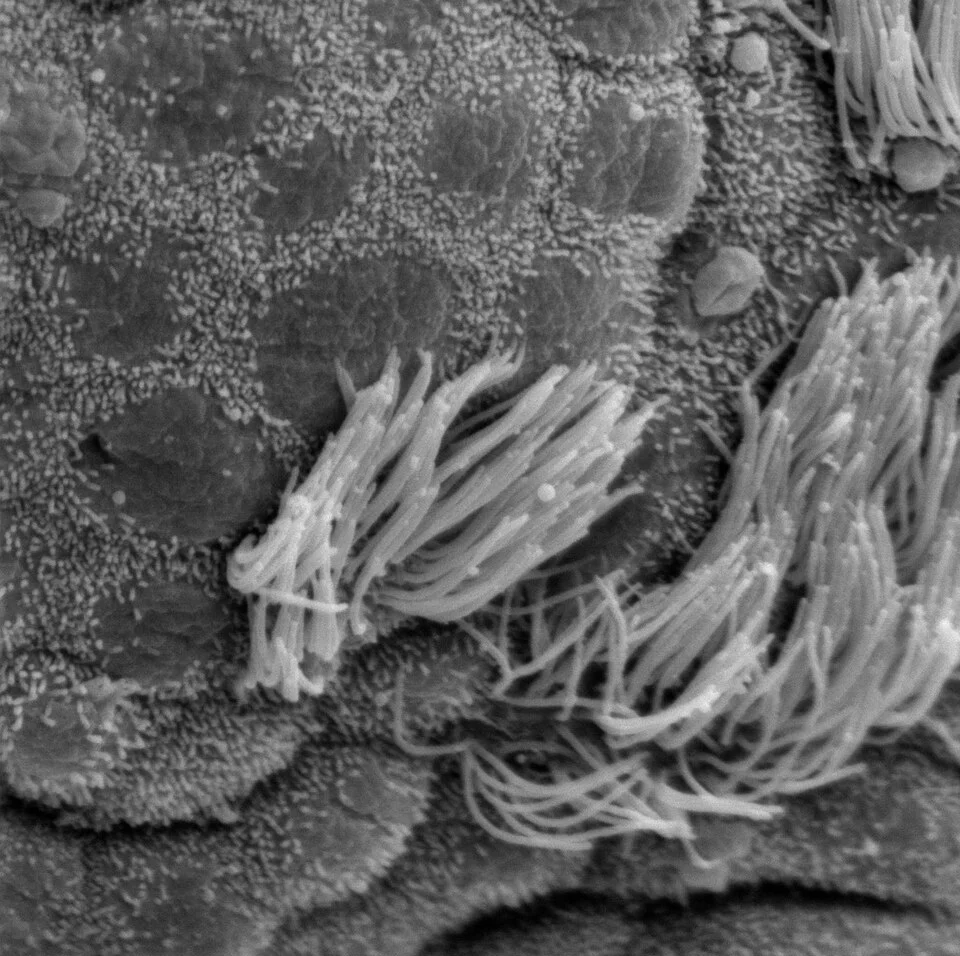 Rasterelektronenmikroskopische Aufnahme eines Bronchiolenepithels: Büschel langer Zilien neben Zelloberflächen, die nur kurze Mikrovilli tragen.