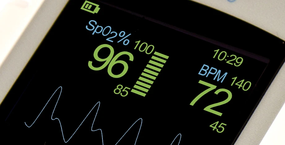 Display eines Handpulsoxymeters mit SpO₂ 96 Prozent, Pulsfrequenz 72 pro Minute und einer Plethysmografiekurve aus gleichmäßigen, gut ausgebildeten Pulswellen.