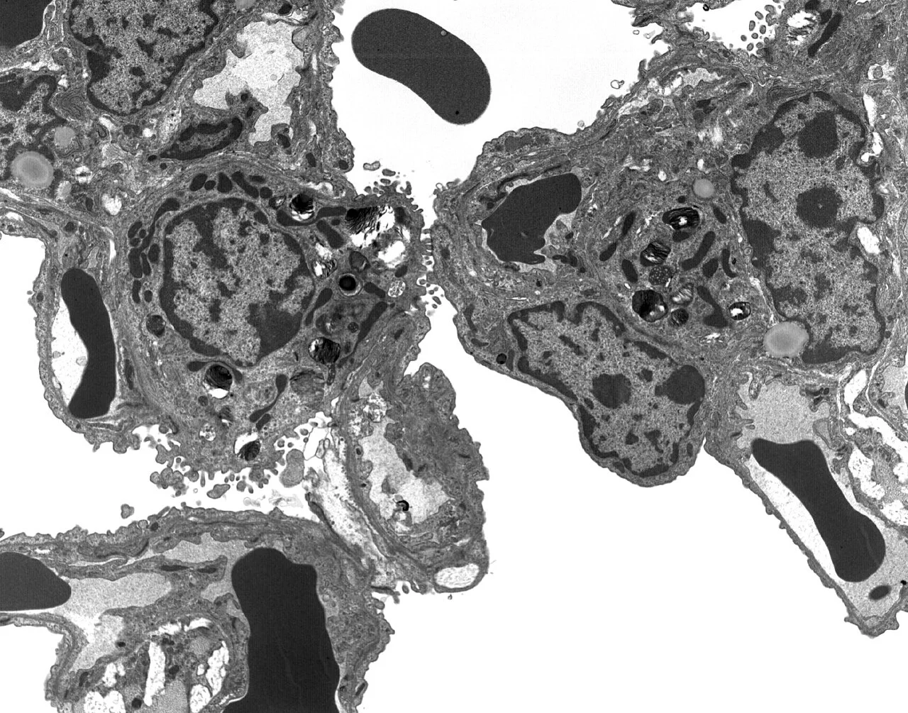 Transmissionselektronenmikroskopische Aufnahme aus der Alveolarregion: Typ-II-Pneumozyten mit dunklen, geschichteten Lamellenkörperchen und Mikrovilli, daneben Kapillaren mit Erythrozyten hinter einer sehr dünnen Wand.