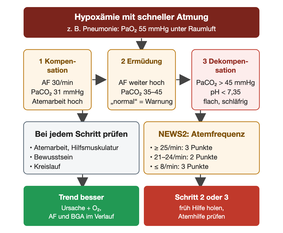 Hypoxämie mit schneller Atmung, zum Beispiel Pneumonie mit PaO₂ 55 mmHg unter Raumluft, in drei Schritten von links nach rechts. 1 Kompensation: Atemfrequenz 30 pro Minute, PaCO₂ 31 mmHg, Atemarbeit hoch. 2 Ermüdung: Atemfrequenz weiter hoch, PaCO₂ 35–45 mmHg, der normale Wert ist eine Warnung. 3 Dekompensation: PaCO₂ über 45 mmHg, pH unter 7,35, flache Atmung, schläfrig. Bei jedem Schritt Atemarbeit mit Hilfsmuskulatur, Bewusstsein und Kreislauf prüfen. NEWS2 für die Atemfrequenz: ab 25 pro Minute 3 Punkte, 21–24 pro Minute 2 Punkte, 8 pro Minute oder weniger 3 Punkte. Ergebnis: Trend besser, dann Ursache und O₂ sowie Atemfrequenz und BGA im Verlauf; Schritt 2 oder 3, dann früh Hilfe holen und Atemhilfe prüfen.