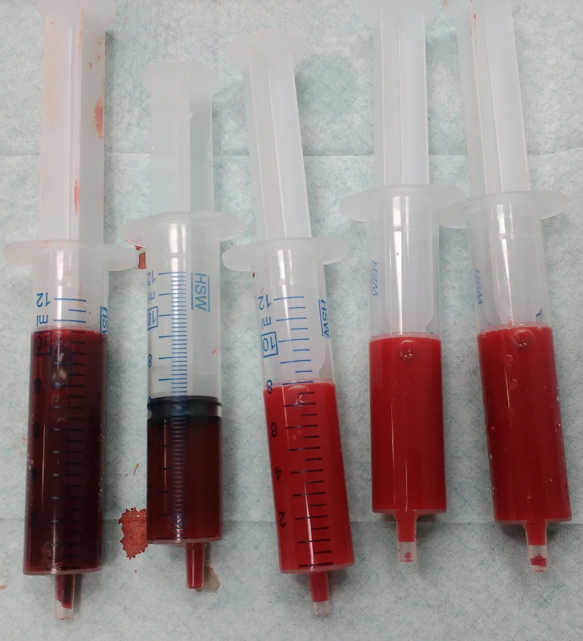 Fünf Spritzen mit Blut nebeneinander: links zwei Proben mit dunkelrotem venösem Blut, rechts drei Proben mit hellrotem arteriellem Blut.