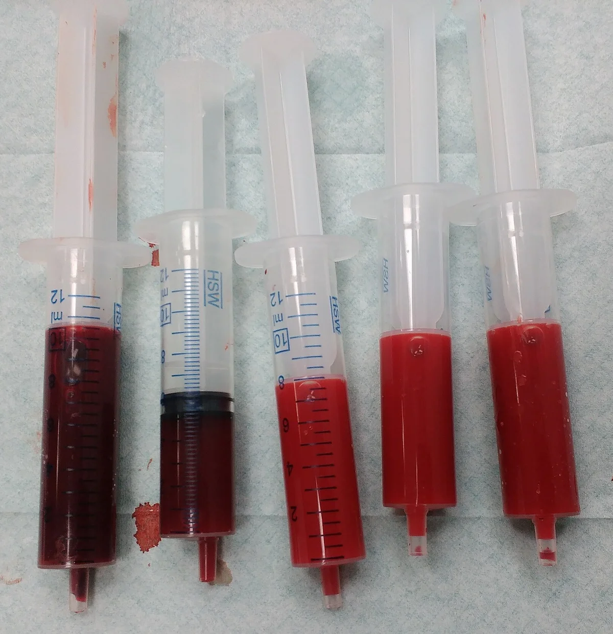 Fünf Spritzen mit Blut nebeneinander auf einer Unterlage: links zwei dunkelrote Proben, rechts drei deutlich hellere, leuchtend rote Proben.