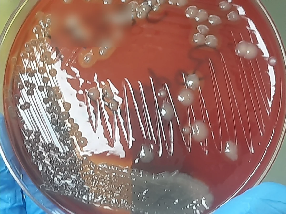 Blutagarplatte mit fraktioniertem Ausstrich: zahlreiche große, flache, unregelmäßige, grau-metallisch glänzende Kolonien auf rotem Nährboden; Beschriftung unkenntlich gemacht.