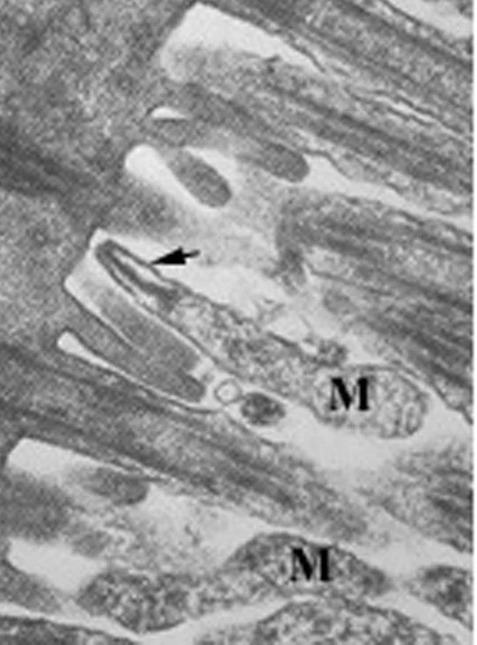Transmissionselektronenmikroskopische Aufnahme: mehrere flaschenförmige Mykoplasmen, mit M markiert, liegen zwischen den Zilien einer Atemwegsschleimhautzelle; ein Pfeil zeigt auf die Spitzenorganelle, mit der ein Erreger an der Zilie haftet.