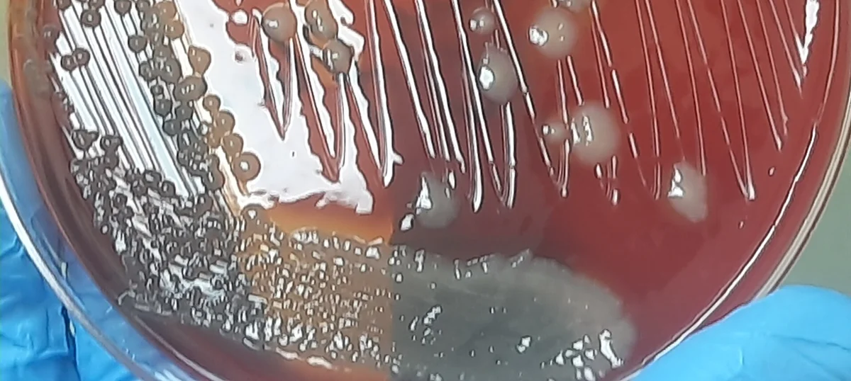 Ausschnitt einer Blutagarplatte, von einer Hand im blauen Handschuh gehalten: große, flache, unregelmäßige, grau-metallisch glänzende Kolonien, teils zusammenfließend.