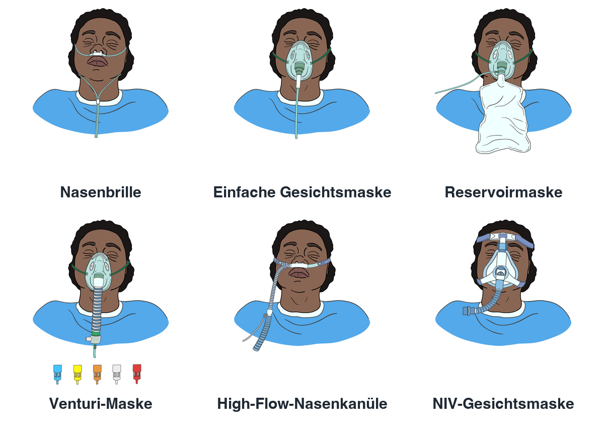 Sechs Zeichnungen eines Kopfes mit verschiedenen Sauerstoffsystemen: Nasenbrille, einfache Gesichtsmaske, Reservoirmaske mit Beutel, Venturi-Maske mit farbcodierten Aufsätzen, High-Flow-Nasenkanüle mit beheiztem Schlauch und dicht sitzende NIV-Gesichtsmaske.
