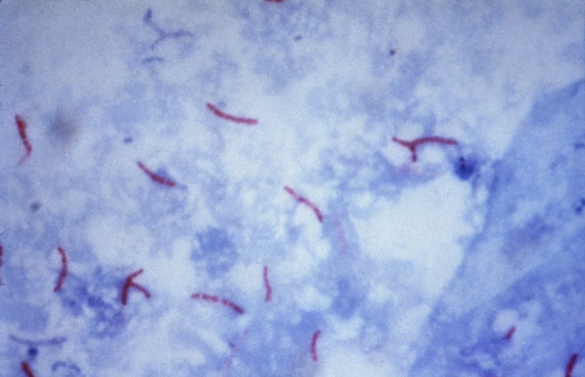 Mikroskopisches Bild mit 1000-facher Vergrößerung: auf blauem Hintergrund zahlreiche schlanke, leicht gebogene, leuchtend rote Stäbchen, einzeln und in kleinen Gruppen.