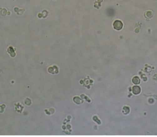 Ungefärbtes Urinsediment im Hellfeld: verstreute kleine, ringförmige Zellen unterschiedlicher Form und Größe, einige mit kleinen bläschenartigen Ausstülpungen am Rand.