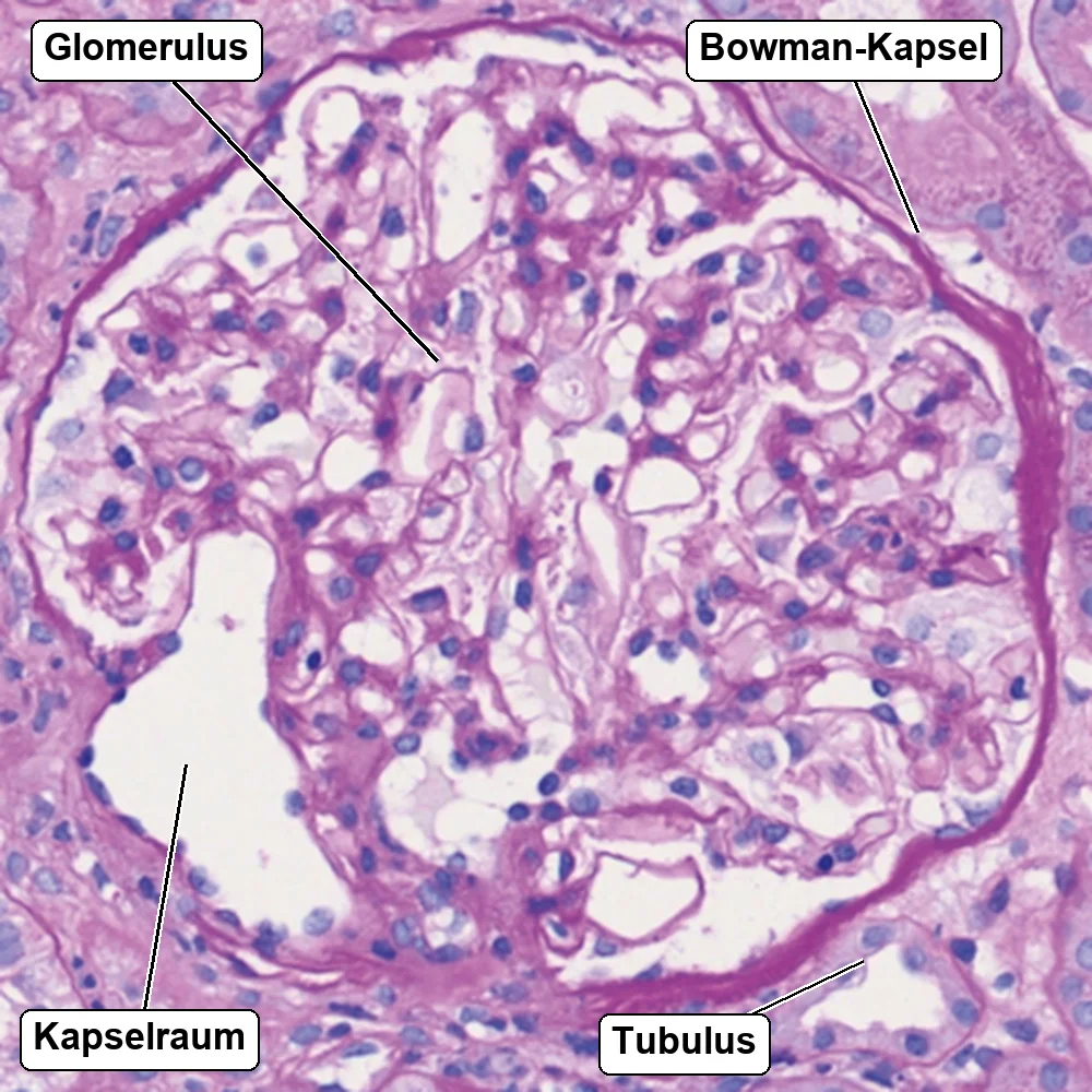 Lichtmikroskopischer Schnitt einer menschlichen Nierenbiopsie in PAS-Färbung: ein normaler Glomerulus mit zartem Kapillarknäuel, umgeben vom hellen Kapselraum und der Bowman-Kapsel, außen Tubulusanschnitte.