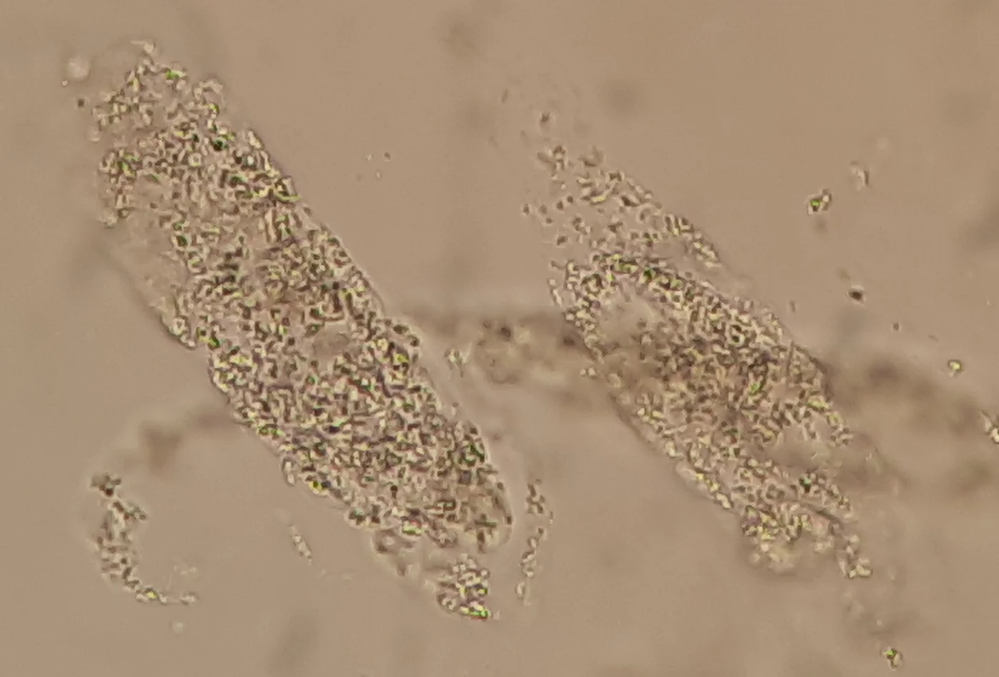 Zwei längliche, grob granulierte Zylinder im ungefärbten Urinsediment.