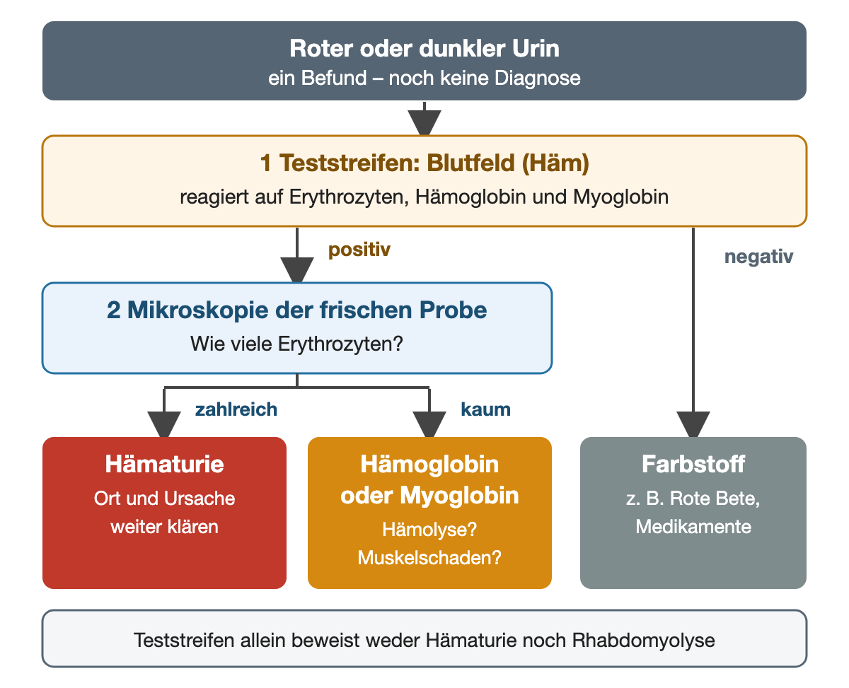 Roter oder dunkler Urin: Bei positivem Blutfeld trennt die Mikroskopie zahlreiche Erythrozyten (Hämaturie) von kaum vorhandenen (Hämoglobin oder Myoglobin); bei negativem Blutfeld kommt ein Farbstoff etwa aus Lebensmitteln oder Medikamenten in Betracht.