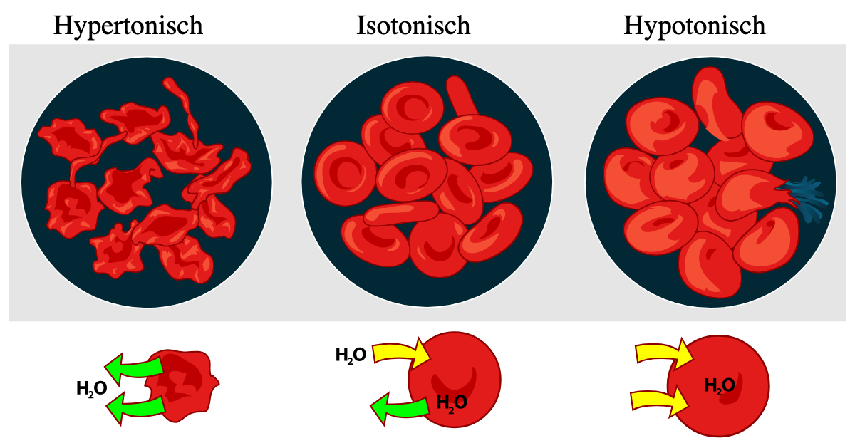 Gezeichnete rote Blutkörperchen in drei Lösungen: In hypertoner Lösung sind sie geschrumpft und gezackt, Pfeile zeigen Wasser aus der Zelle heraus; in isotoner Lösung haben sie normale bikonkave Form bei gleichem Ein- und Ausstrom; in hypotoner Lösung sind sie geschwollen und eine Zelle platzt, Pfeile zeigen Wasser in die Zelle hinein.