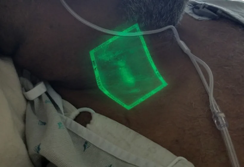 Hals einer liegenden Person mit Sauerstoffbrille, Kopf zur Seite gedreht; in einem grün projizierten Feld eines Venensichtgeräts zeichnet sich ein breiter, heller Venenstreifen ab; darunter Bettwäsche und Patientenhemd.