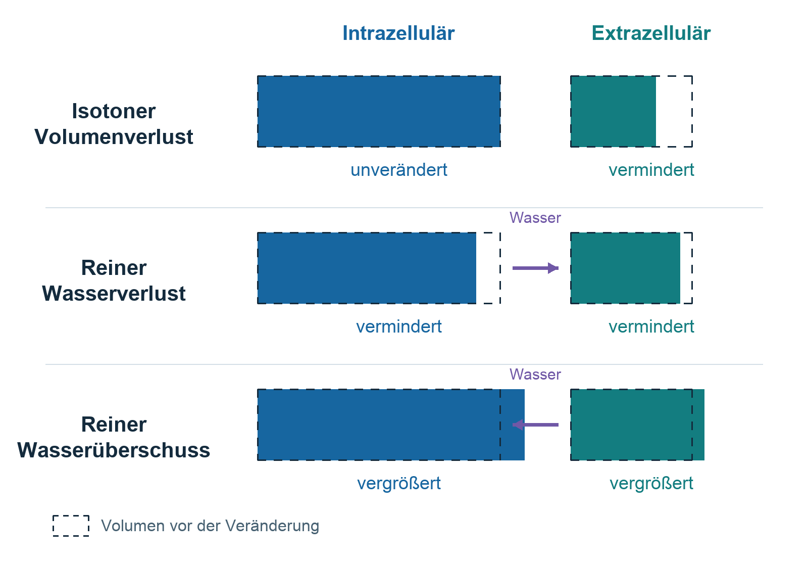 Schematische Wasserbewegung zwischen Intrazellulärraum und Extrazellulärraum bei veränderter extrazellulärer Tonizität.