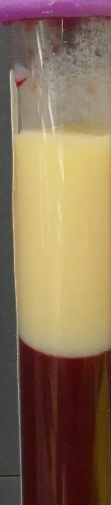 Ausschnitt eines Blutröhrchens nach längerem Stehen: oben eine dicke, undurchsichtige, milchig-gelbe Plasmaschicht, darunter die abgesetzten dunkelroten Blutzellen.