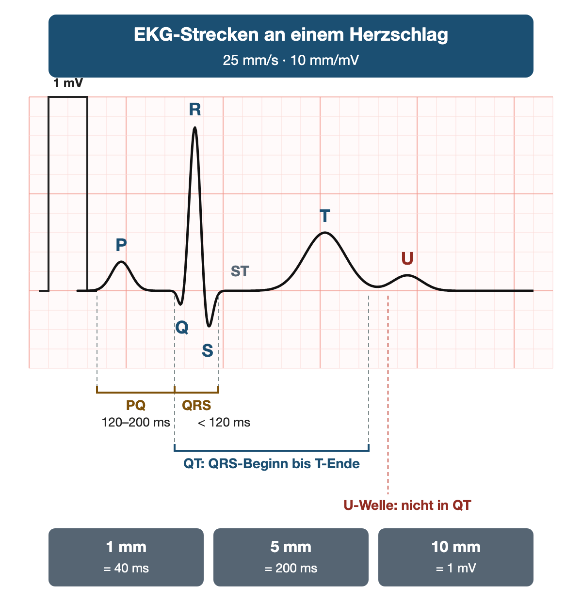 Schematischer Herzschlag auf EKG-Papier mit 1-mV-Eichzacke: P-Welle, Q, R, S, ST-Strecke, T-Welle und kleine U-Welle beschriftet. Darunter Messklammern: PQ vom P-Beginn bis zum QRS-Beginn, 120 bis 200 ms; QRS kleiner als 120 ms; QT vom QRS-Beginn bis zum Ende der T-Welle. Eine rote Linie markiert die U-Welle nach dem T-Ende mit dem Hinweis: nicht in QT. Unten drei Kästen: 1 mm entspricht 40 ms, 5 mm entsprechen 200 ms, 10 mm entsprechen 1 mV.