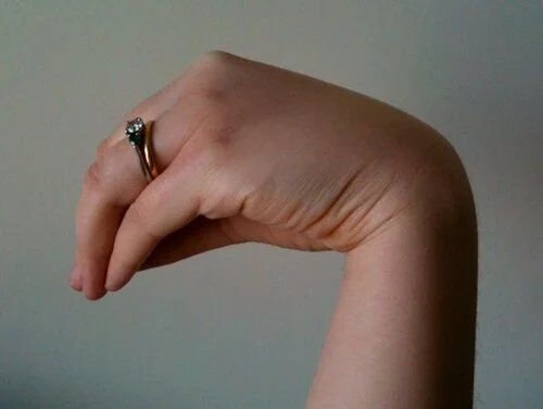 Foto einer Hand vor hellem Hintergrund: Das Handgelenk ist gebeugt, die Finger sind in den Grundgelenken gebeugt und in den Mittel- und Endgelenken gestreckt, der Daumen liegt an.