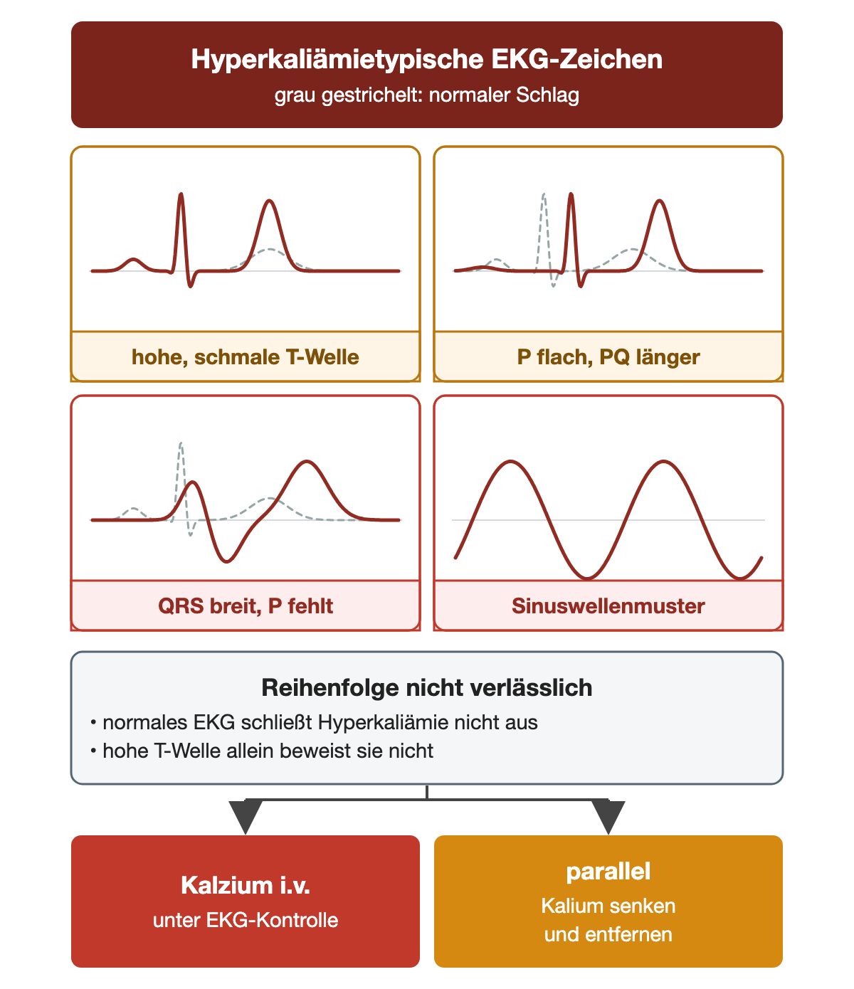 Vier vereinfachte Herzschläge mit grau gestricheltem Normalschlag zum Vergleich: hohe, schmale T-Welle; flache P-Welle mit längerem PQ; breiter QRS-Komplex ohne P-Welle; Sinuswellenmuster. Die Reihenfolge ist nicht verlässlich, ein normales EKG schließt eine Hyperkaliämie nicht aus und eine hohe T-Welle allein beweist sie nicht. Folge: Kalzium intravenös unter EKG-Kontrolle und parallel Kalium senken und entfernen.