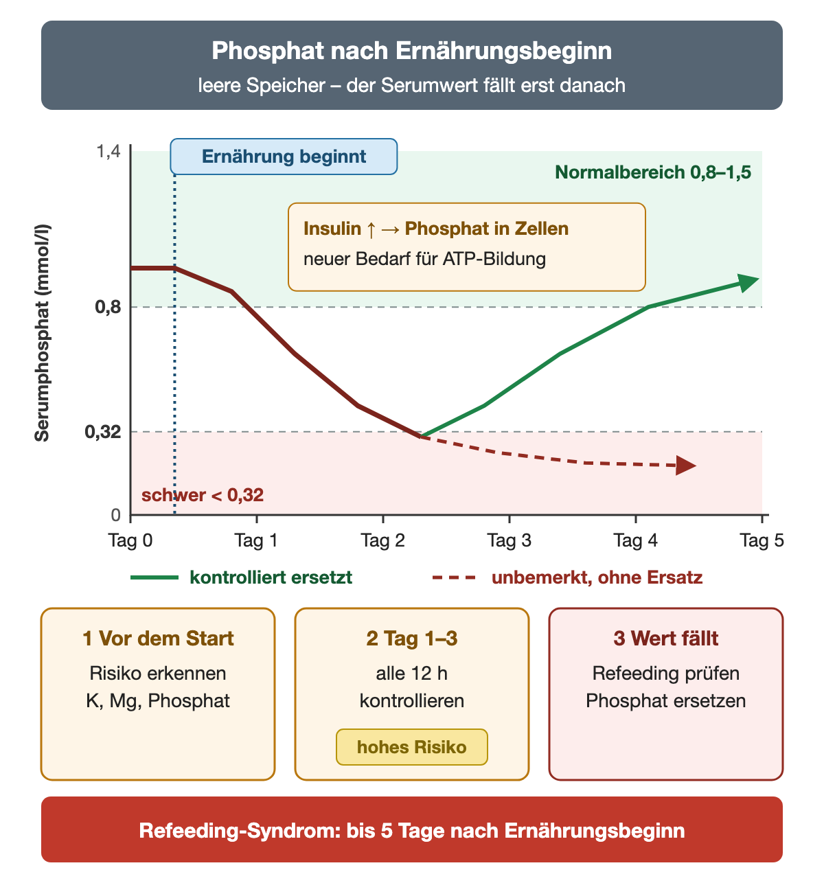 Liniendiagramm des Serumphosphats über die Tage 0 bis 5 mit grünem Normalbereich 0,8 bis 1,5 mmol/l und rotem Bereich unter 0,32 mmol/l. Bei Ernährungsbeginn liegt der Wert noch normal, fällt dann bis Tag 2 bis 3 in den schweren Bereich, weil Insulin Phosphat in die Zellen verschiebt und der Bedarf für die ATP-Bildung steigt. Danach steigt die grüne Linie bei kontrolliertem Ersatz wieder in den Normalbereich, die gestrichelte rote Linie bleibt unbemerkt tief. Darunter drei Schritte: vor dem Start Risiko erkennen und Kalium, Magnesium und Phosphat bestimmen; an Tag 1 bis 3 bei hohem Risiko alle 12 Stunden kontrollieren; fällt der Wert, Refeeding-Syndrom prüfen und Phosphat ersetzen. Unten: Refeeding-Syndrom bis 5 Tage nach Ernährungsbeginn.