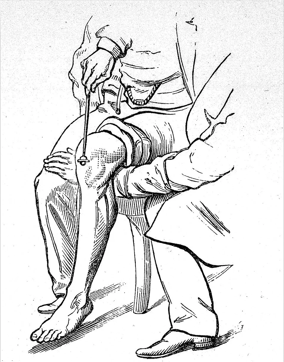 Historische Strichzeichnung: Ein Untersucher beklopft mit einem Reflexhammer die Sehne unterhalb der Kniescheibe einer sitzenden Person, deren Unterschenkel frei hängt.