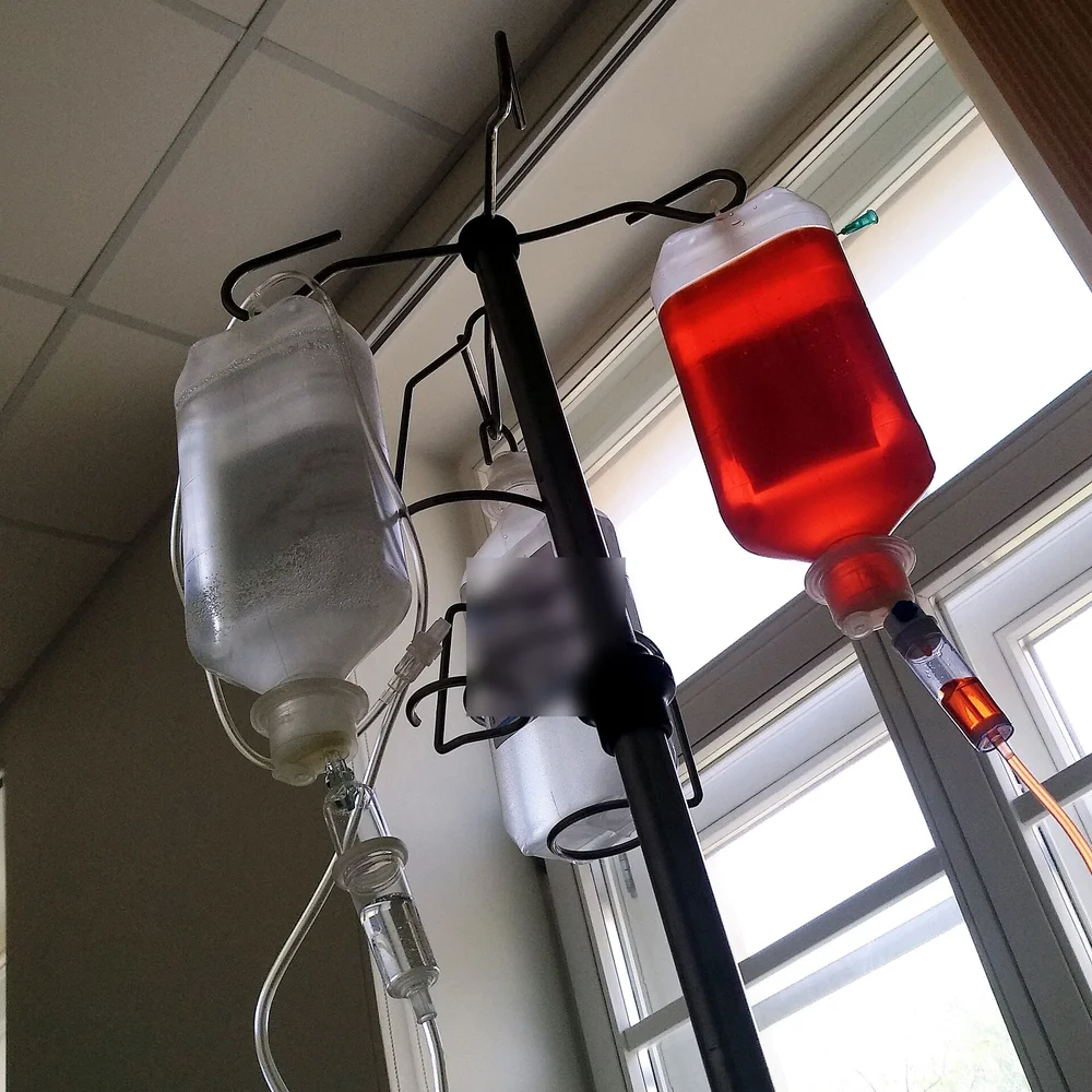 Blick von unten auf einen Infusionsständer mit drei hängenden Infusionsbehältern; der rechte Beutel enthält eine kräftig rote Lösung, das Etikett der mittleren Flasche ist unkenntlich gemacht.