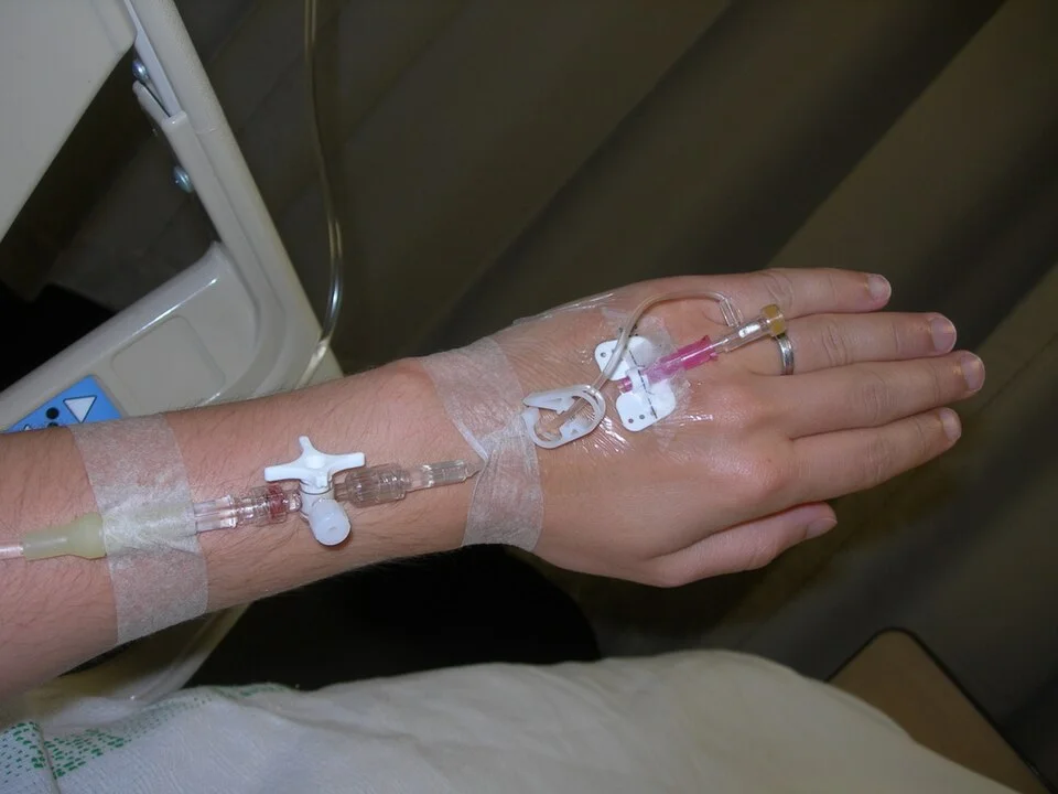Linker Handrücken und Unterarm mit einer pflasterfixierten Venenverweilkanüle; über einen Dreiwegehahn am Unterarm ist eine Infusionsleitung angeschlossen.