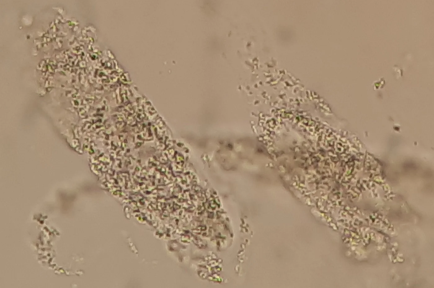 Ungefärbtes Urinsediment mit zwei länglichen, zylinderförmigen Gebilden, die dicht mit groben, unregelmäßigen Körnchen gefüllt sind, vor hellbraunem Hintergrund.