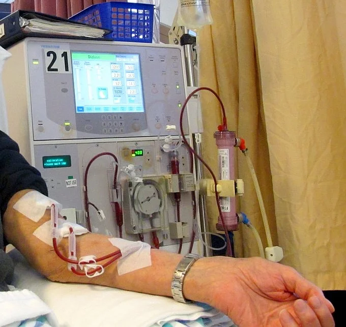 Foto einer laufenden Hämodialyse: Blutschläuche führen vom Unterarm zur Blutpumpe des Dialysegeräts und durch einen senkrecht montierten Dialysator zurück. Oben zeigt der Bildschirm die Behandlungsparameter.