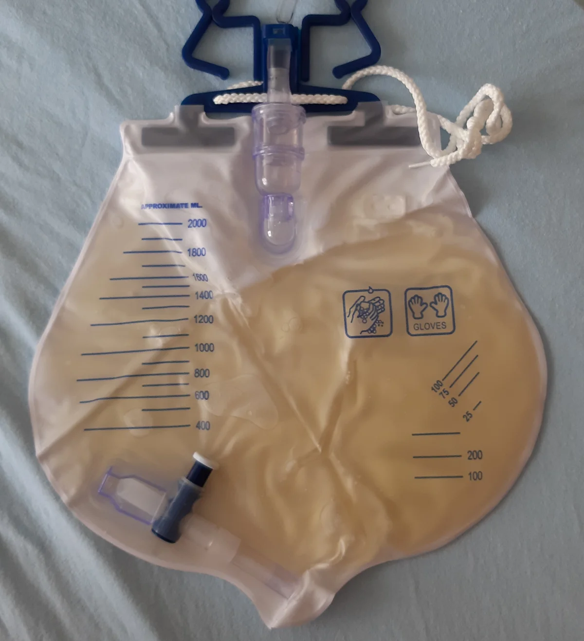 Foto eines flach liegenden Urinbeutels mit gelbem Urin. Die aufgedruckte Skala links ist nur in Schritten von 100 bis 200 ml von 400 bis 2000 ml beschriftet; rechts unten gibt es nur wenige feine Markierungen.