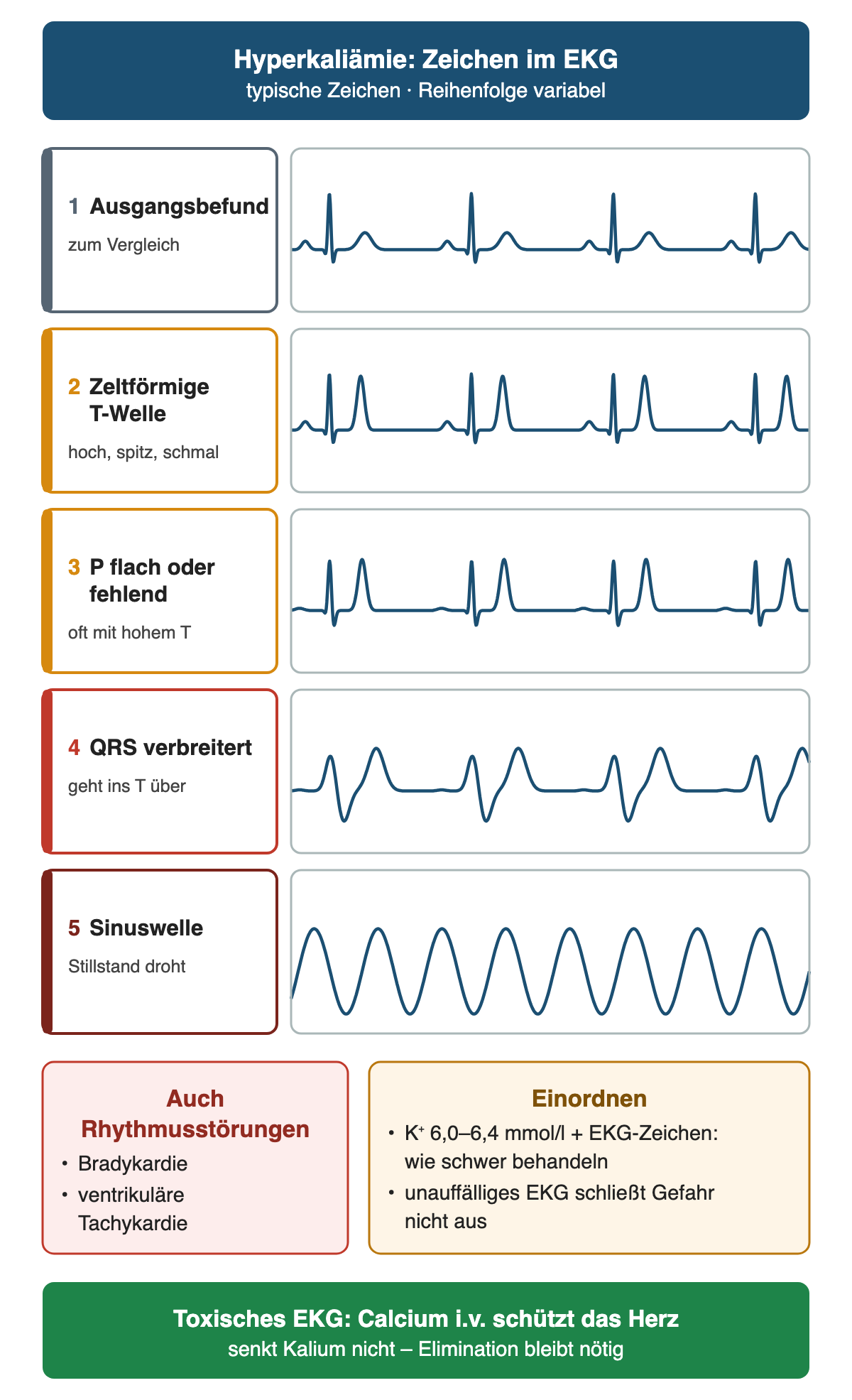 Fünf stilisierte Zeichenkurven ohne Raster: Ausgangsbefund, zeltförmige T-Welle, flache oder fehlende P-Welle, verbreiterter QRS-Komplex und Sinuswelle; darunter Rhythmusstörungen, Einordnung bei Kalium 6,0–6,4 mmol/l und Calcium als Herzschutz.