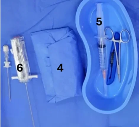 Auf einem sterilen blauen Tuch: links eine automatische Biopsienadel (6), in der Mitte eine gefaltete sterile Schutzhülle für den Ultraschallkopf (4), rechts eine Nierenschale mit Spritze zur Lokalanästhesie, Klemme und Skalpell (5).